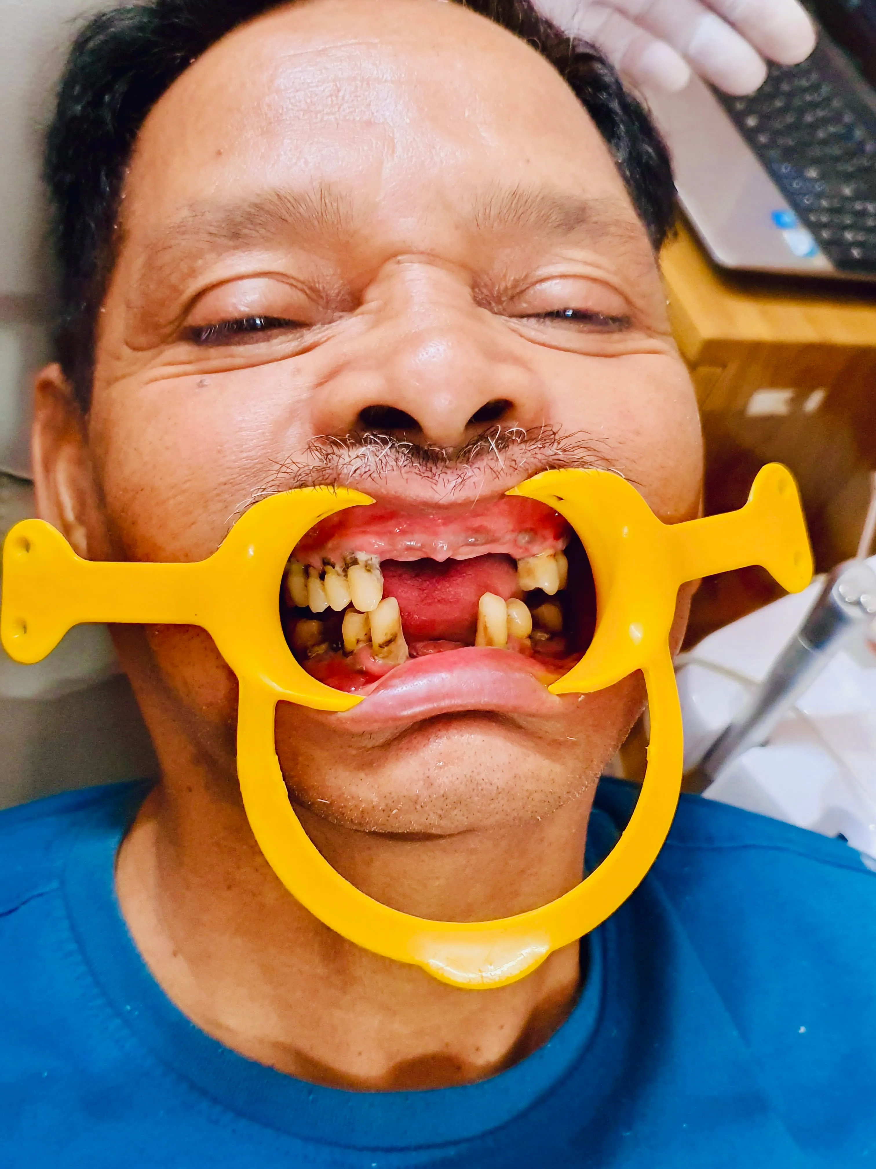 Before Dental Treatment