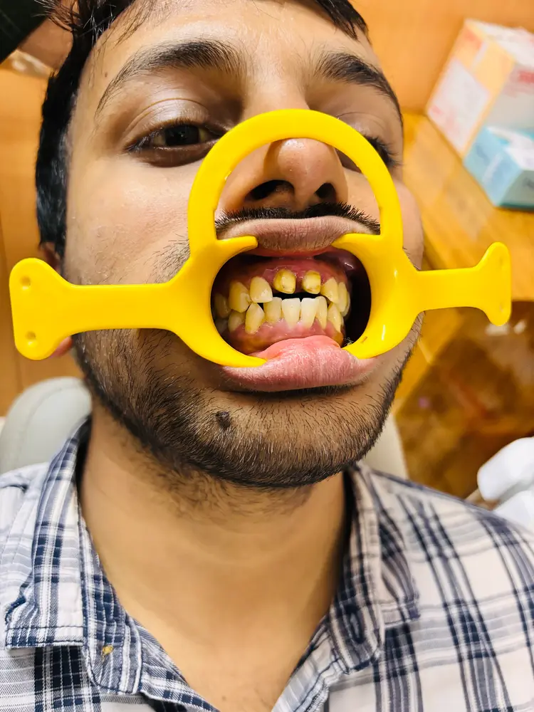 Before Dental Treatment