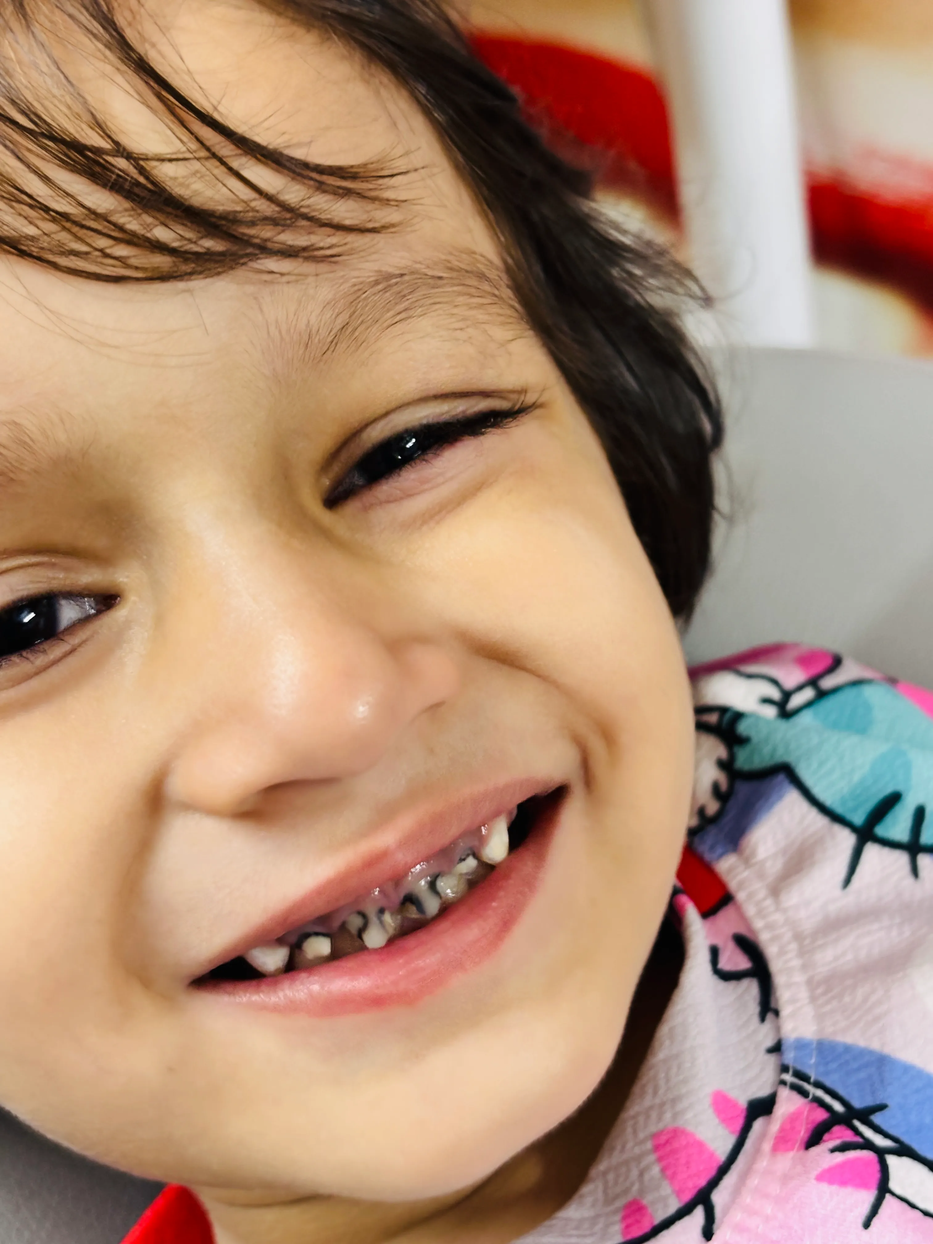 Before Dental Treatment