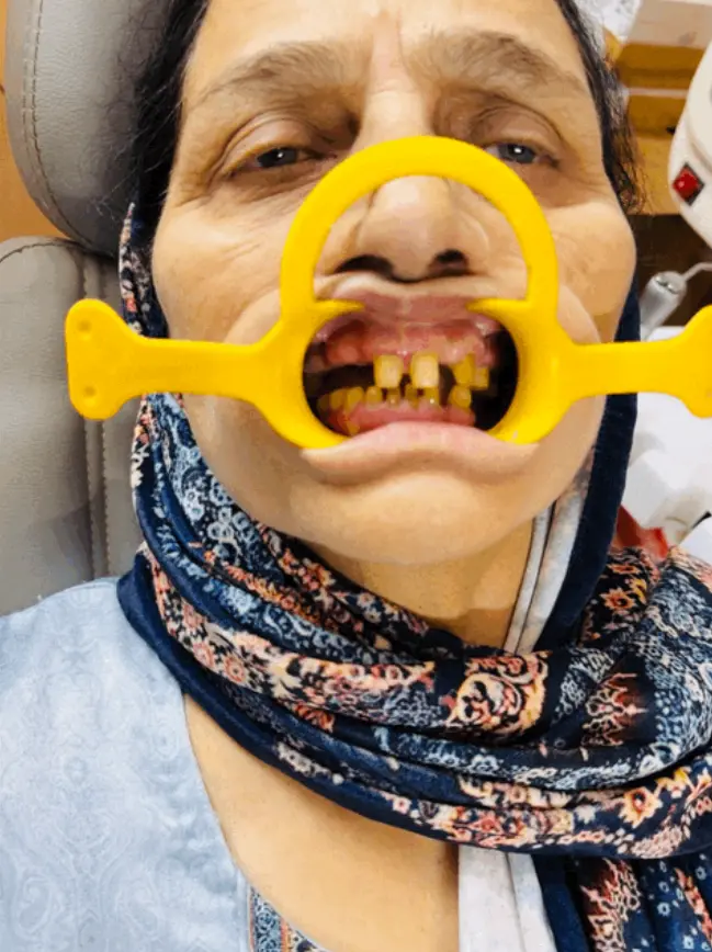 Before Dental Treatment