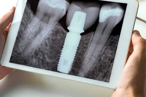 Digital X-Ray icon at Riya Smile Care Centre Uttam Nagar Delhi